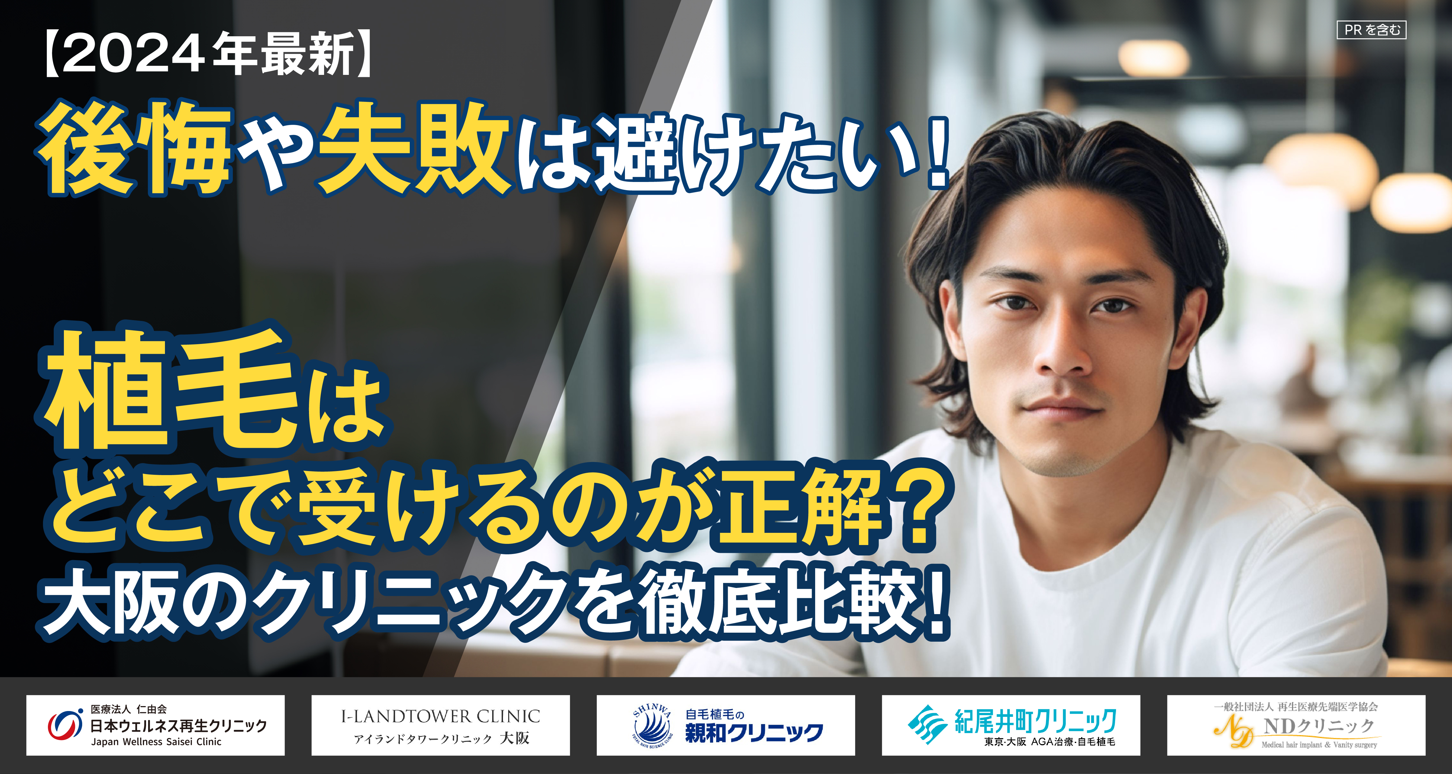 【2024年最新】公開や失敗は避けたい！植毛はどこで受けるのが正解？大阪のクリニックを徹底比較！